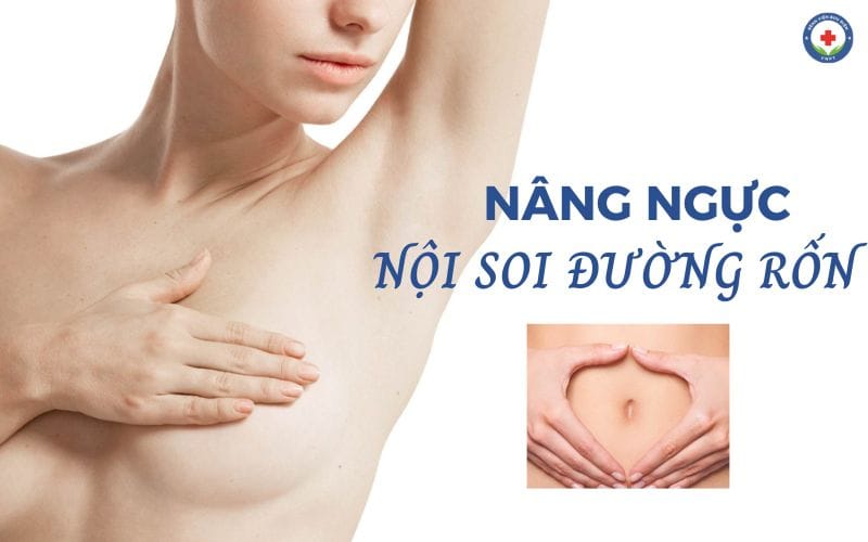 Nâng ngực nội soi đường rốn phù hợp với chị em có lồng ngực nhỏ