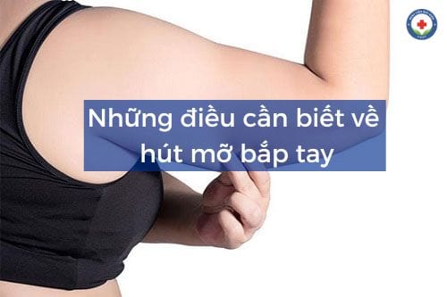 Hút mỡ bắp tay là phương pháp làm đẹp giúp loại bỏ mỡ thừa dưới cánh tay