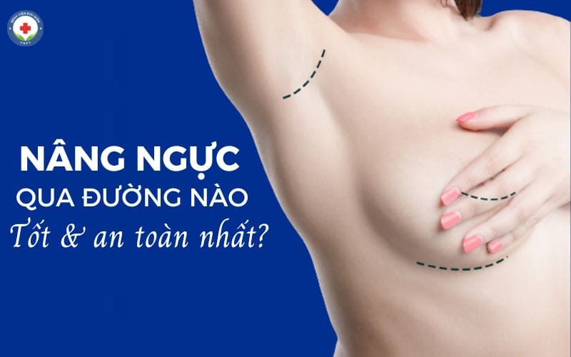 Để đánh giá đường nâng ngực tốt phải dựa trên tính an toàn và thẩm mỹ