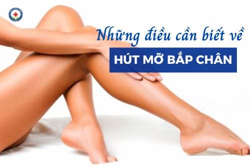 Những điều cần biết về hút mỡ bắp chân